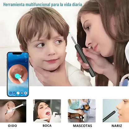 EARCLEANER® KIT LIMPIEZA OÍDOS PROFESIONAL CON CÁMARA ULTRAHD