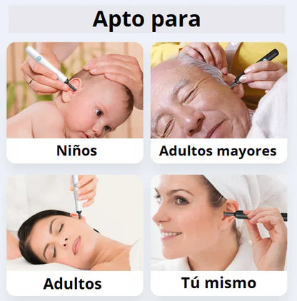 EARCLEANER® KIT LIMPIEZA OÍDOS PROFESIONAL CON CÁMARA ULTRAHD