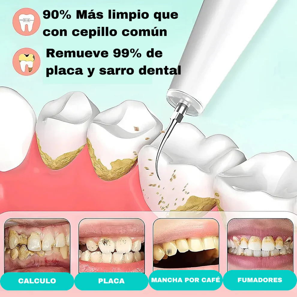 DentalClean ® : Quita Sarro + Cepillo dientes eléctrico - ¡ADIÓS AL DENTISTA! 😱